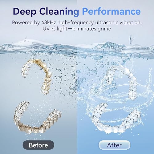 Manufacturer before-and-after graphic contrasting a stained aligner with a clear one after ultrasonic and UV-C cleaning